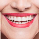 Small Changes, Big Smile Transformations